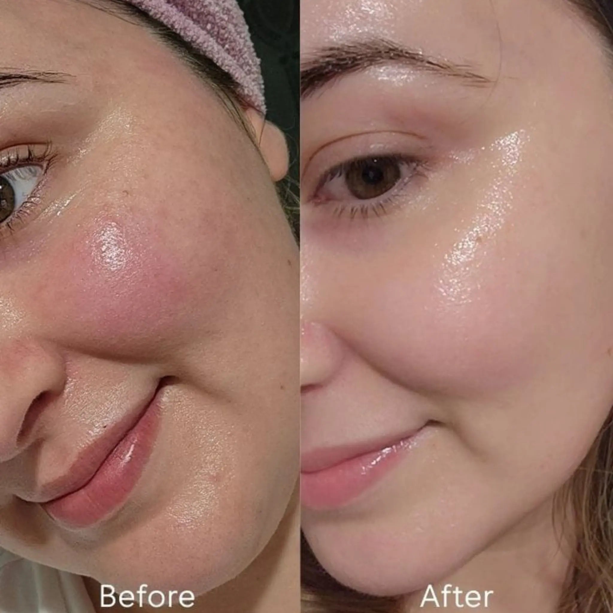 Glitter Skin Glutathione Brightening Serum 30ml with Glutathione, Niacinamide, Alpha Arbutin & Hyaluronic Acid