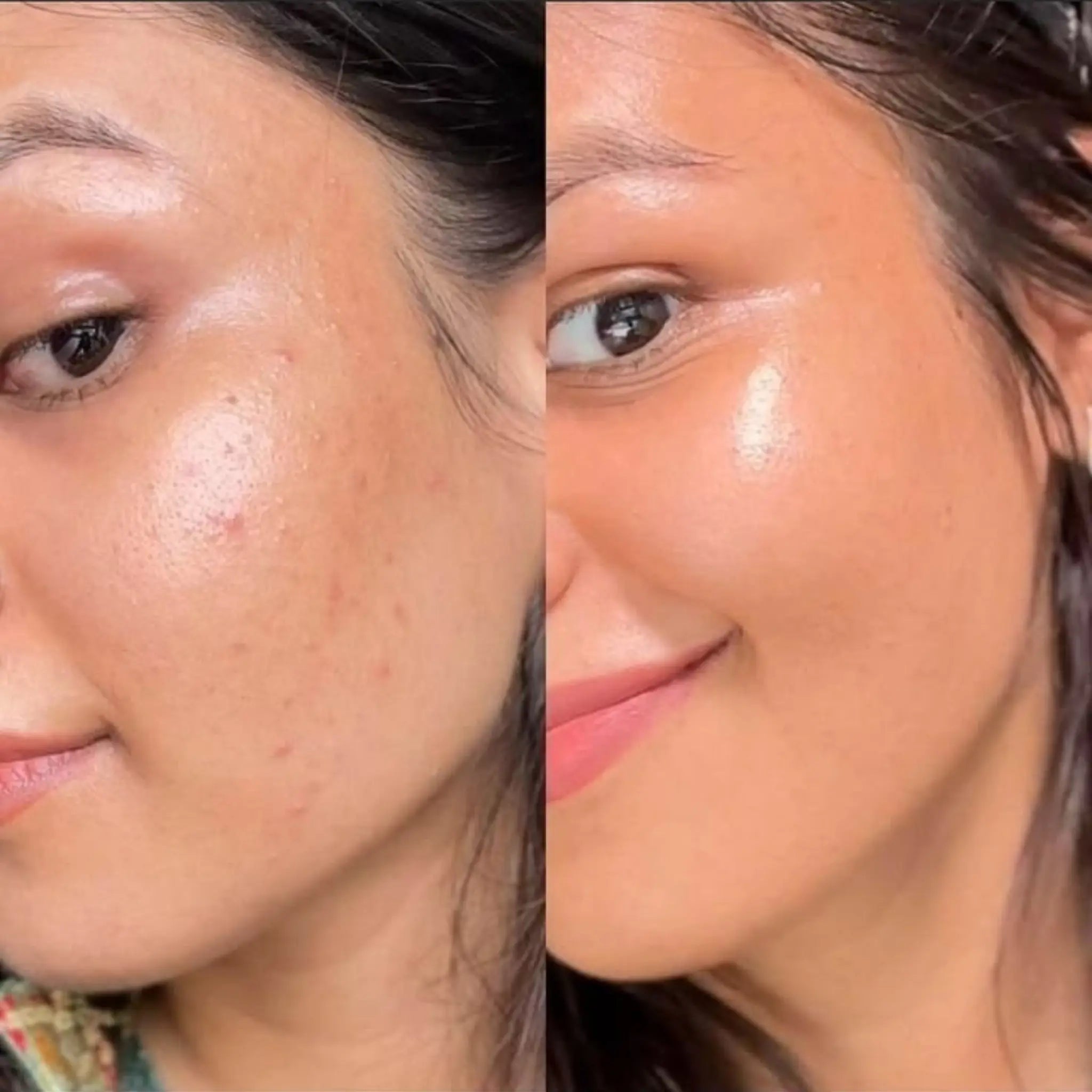 Glitter Skin Vitamin C Radiance Serum 30ml with Vitamin C, Niacinamide, Alpha Arbutin & Hyaluronic Acid